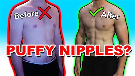 Puffy Nipples and How To Get Rid of Them